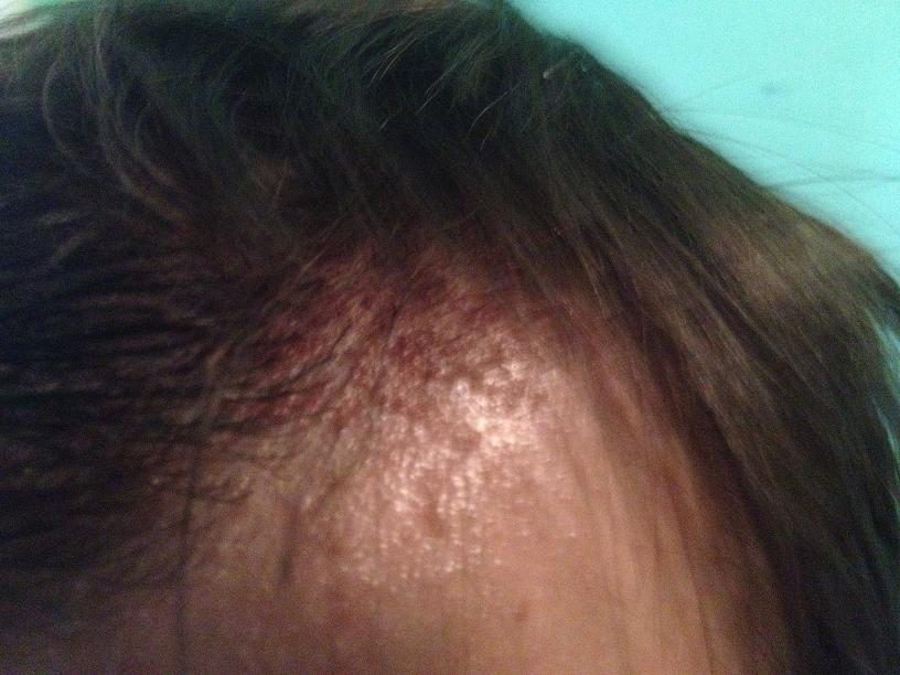 index.php/fa/9548/0/