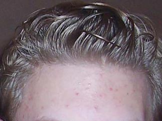 index.php/fa/9551/0/