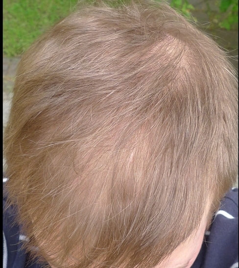 index.php/fa/9593/0/