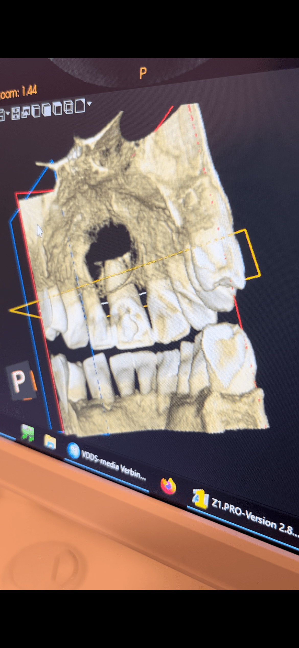 /fud/index.php?t=getfile&id=33540&private=0